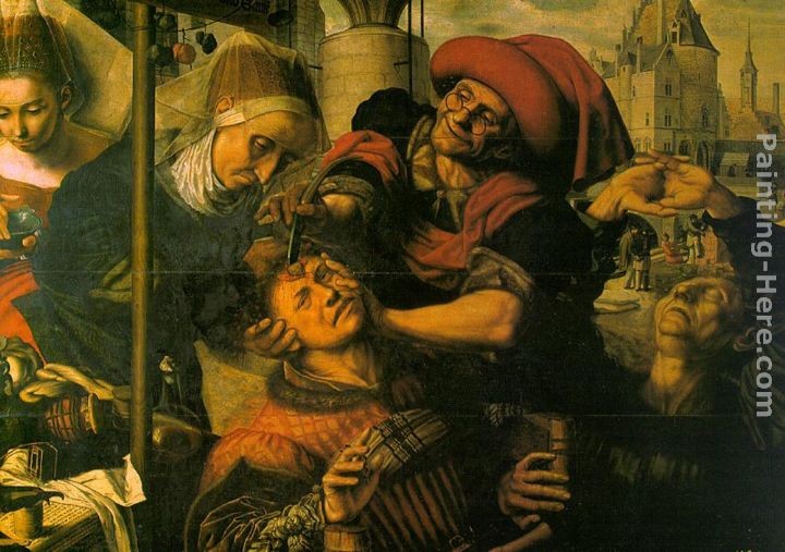 Jan Sanders van Hemessen The Surgeon